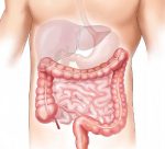 suboclusao-intestinal-saiba-mais-sobre-esse-tipo-de-obstrucao-do-intestino-cbcd-dcd