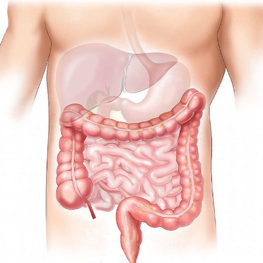 suboclusao-intestinal-saiba-mais-sobre-esse-tipo-de-obstrucao-do-intestino-cbcd-dcd